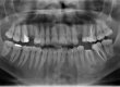 Fig.4-Panoramica Dentale o Ortopantomografia (Officina Odontoiatrica)